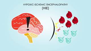 HypoxicIschemic Encephalopathy About Treatments amp Causes [upl. by Danita]