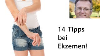 14 Tipps um Ekzeme behandeln [upl. by Kendyl]