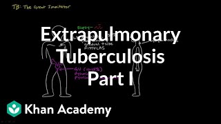 Extrapulmonary TB part 1  Infectious diseases  NCLEXRN  Khan Academy [upl. by Esidarap]