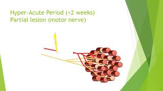 Nerve damage and repair [upl. by Aniraz]