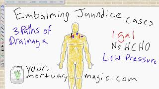 Embalming the Jaundice Case [upl. by Aniar]