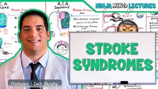 Stroke Syndromes MCA ACA ICA PCA Vertebrobasilar Artery Strokes  Pathophysiology [upl. by Eimak96]