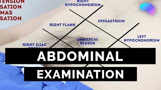 Abdominal Examination  OSCE Guide Latest  UKMLA  CPSA  PLAB 2 [upl. by Aistek]