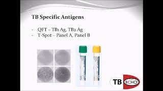 QFT and T SPOT TB Tests What do the numbers mean [upl. by Raynell861]