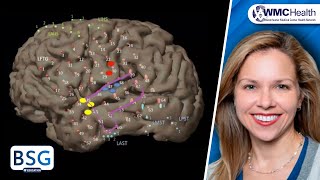 Temporal Lobe Epilepsy Seminar 1 Overview [upl. by Marcile]