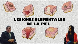 Lesiones Elementales de la Piel [upl. by Ermanno]