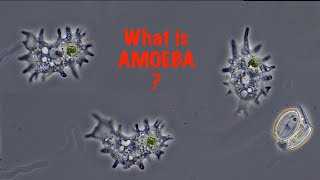 What is Amoeba [upl. by Nivek405]