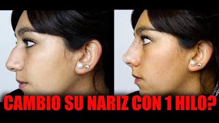 Hilos tensores nariz 🔥  Rinomodelación con hilos  Todo sobre la RINOPLASTIA CON HILOS 😱 [upl. by Yenruoj]