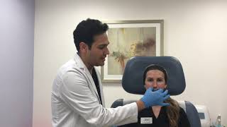 Botox treatment for gummy smile by Dr Shaun Patel [upl. by Cobbie397]