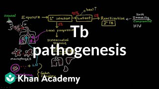 TB pathogenesis  Infectious diseases  NCLEXRN  Khan Academy [upl. by Cataldo275]