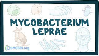 Mycobacterium leprae  an Osmosis Preview [upl. by Drazze]