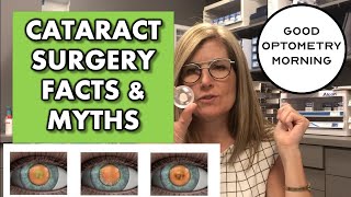 CATARACT SURGERY FACTS amp MYTHS Frequently asked questions about cataract surgery [upl. by Ralina]