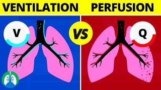 VentilationPerfusion VQ Ratio  Quick Medical Overview [upl. by Virginie]