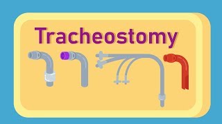 What is Tracheostomy [upl. by Wieche]