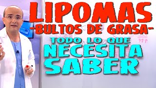 LIPOMAS BULTOS DE GRASA  Todo lo que necesita saber  Enfermedades 36 [upl. by Rafaello]