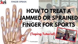 How To Treat a Jammed or Sprained Finger For Sports [upl. by Naux83]