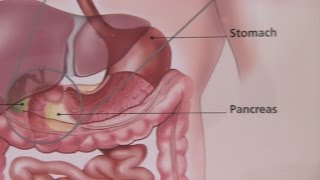 Irritable Bowel Syndrome amp Its Symptoms [upl. by Tertius]