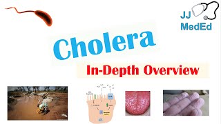 Cholera Vibrio Cholerae Pathophysiology Risk Factors Symptoms Diagnosis and Treatment [upl. by Hayidan237]