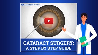 How Does YAG Capsulotomy Treat Blurred Vision After Cataract Surgery [upl. by Mcdermott337]