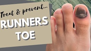 Runners Toe How to prevent and treat black toenails [upl. by Plantagenet]