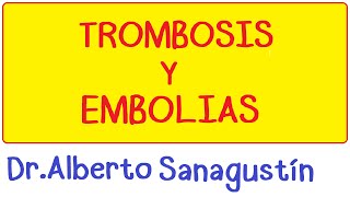 ¿Qué es una embolia pulmonar [upl. by Aivonas]