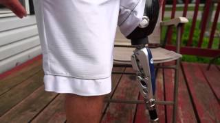 AmputeeOT How An Above Knee AK Prosthetic Leg Works [upl. by Araec626]