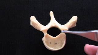 Typical Vertebra  Spinal column  Anatomy [upl. by Ehcropal]