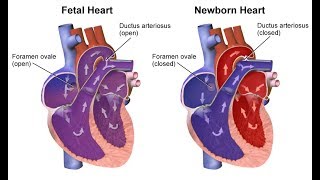 Clasificación Clínica de las Cardiopatías Congénitas [upl. by Rehttam549]