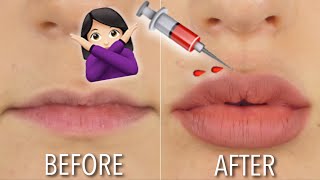 HOW TO GET FULLER LIPS AT HOME  NO FILLER  DIY  Hannah Dorman [upl. by Jak]