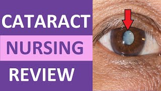 What are cataracts amp when would I need cataract surgery [upl. by Luben718]