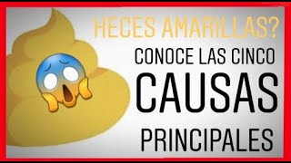 ✅Heces amarillas y las principales causas VÍDEO MUY IMPORTANTE [upl. by Lennie]