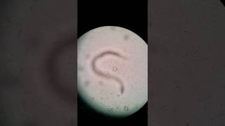 HookwormAncyclostoma Rhabditiform larvae Canine [upl. by Mencher]