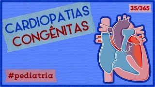 Cardiopatía isquémica 1 Angina estable SCA angina inestable IMACEST IMASEST [upl. by Seugram]