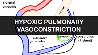 Hypoxic Pulmonary Vasoconstriction HPV [upl. by Tremain]