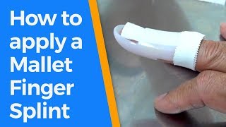 How to apply a Mallet Finger Splint [upl. by Idaf658]