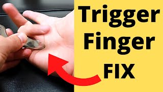 FIX Trigger Finger in 5 Minutes 3 Steps [upl. by Havelock]