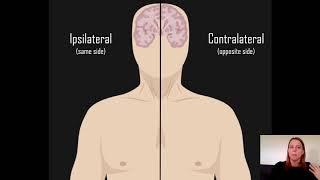 Ipsilateral vs Contralateral [upl. by Ayanaj]