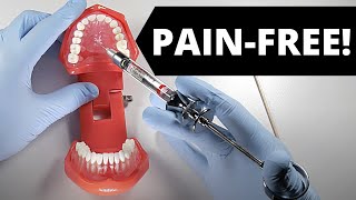 Deliver A Painless Palatal Injection  OnlineExodontiacom [upl. by Ennahtur]