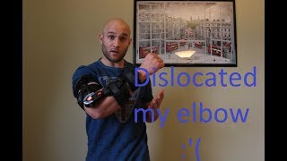 Dislocated Elbow Recovery Part 1 [upl. by Maise]