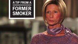 CDC Tips From Former Smokers  Terrie H “Terrie What Are You Doing” [upl. by Atimed]