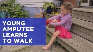 Young amputee learns to walk [upl. by Henigman]