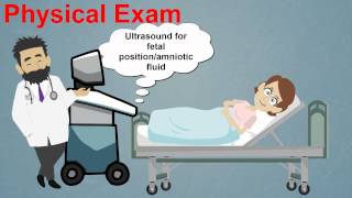 Topic 25 Premature Rupture of Membranes [upl. by Uttica]