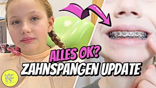 ZAHNSPANGENUPDATE 🦷 DM EINKAUF 🛍 XXL VLOG  KLEINE FAMILIENWELT [upl. by Nitaf246]