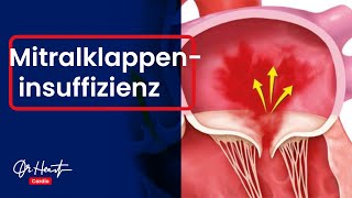 Mitralklappeninsuffizienz  einfach erklärt  DrHeart [upl. by Zephaniah]