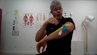 K Taping for Tennis Elbow [upl. by Mackie475]