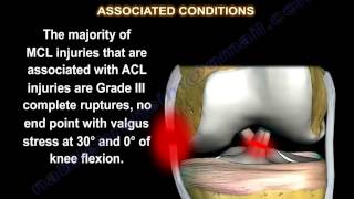 Lateral elbow ligament rupture and common extensor tendon injury [upl. by Kcirreg]