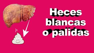 Las Heces Blancas o Pálidas son PELIGROSAS ¿Debería preocuparme [upl. by Arihday868]