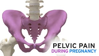 Pelvic Pain During Pregnancy [upl. by Shanie]