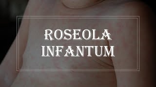 Pediatrics Infectious disease  Roseola infantum exanthem subitum [upl. by Eenehs785]