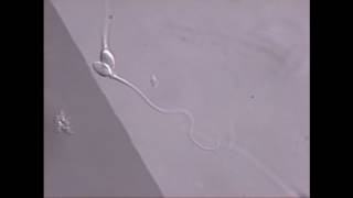 Sperm swimming in microscope field [upl. by Agee152]